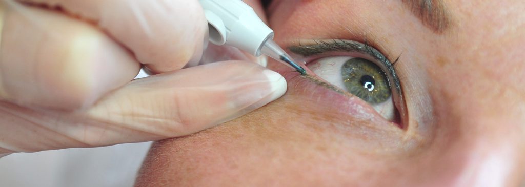 Eyeliner Treatment in Progress